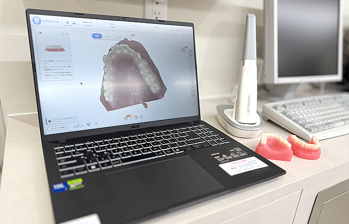 光学3Dスキャナー（IOS）