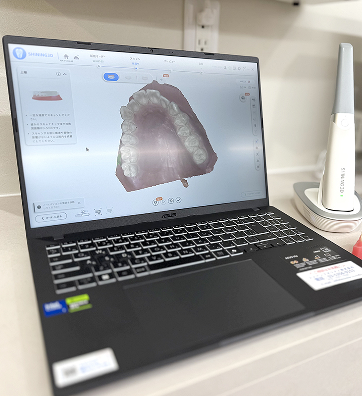 光学3Dスキャナー